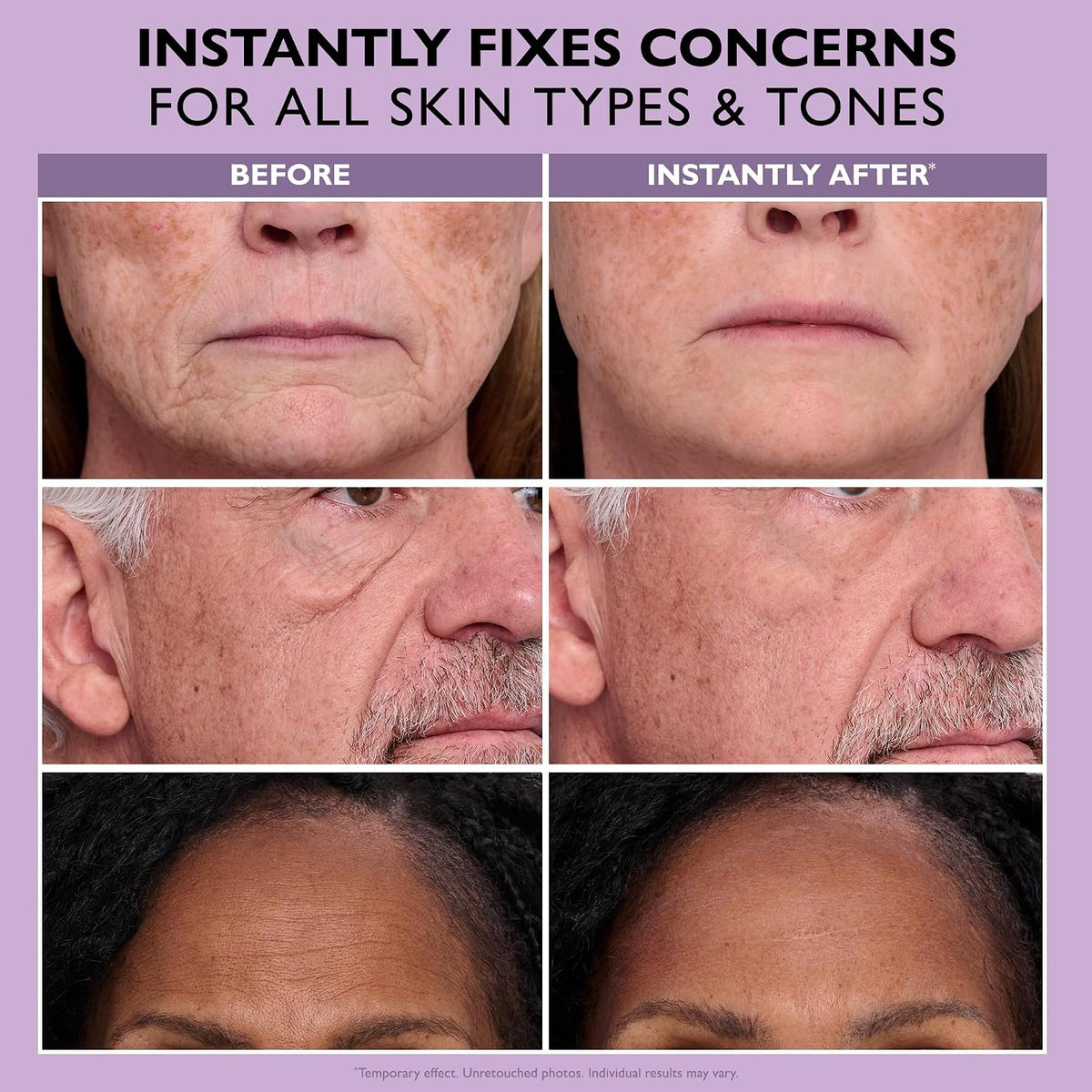 LOVILDS™ Instant Face & Eye Tightener